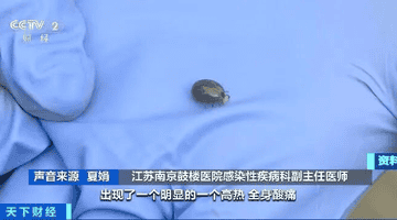 户外露营 小心被这种虫子“贴贴”!