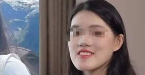 武汉女孩正颌手术遭反向操作 多地专家会诊指需七次修复