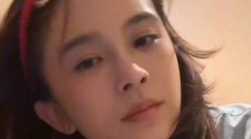 赵樱子自曝把脸部填充都融掉了,只剩假体鼻子无法复原