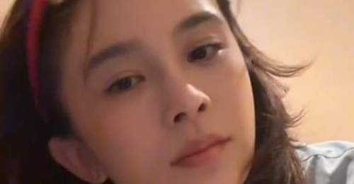 赵樱子自曝把脸部填充都融掉了,只剩假体鼻子无法复原