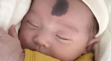 孕期哪些行为容易让宝宝长胎记?妇产科大夫提醒这4件事别做,参与孕妈们都来避开这些坑