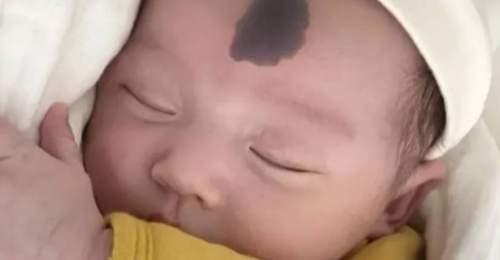 孕期哪些行为容易让宝宝长胎记?妇产科大夫提醒这4件事别做,参与孕妈们都来避开这些坑