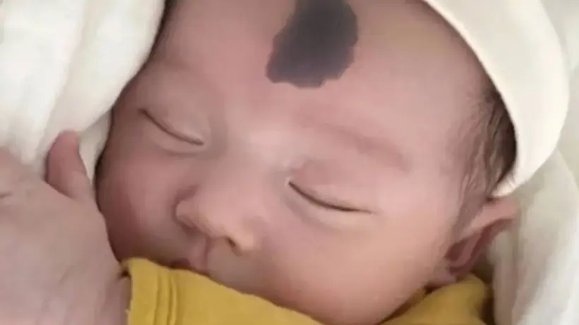 孕期哪些行为容易让宝宝长胎记?妇产科大夫提醒这4件事别做,参与孕妈们都来避开这些坑
