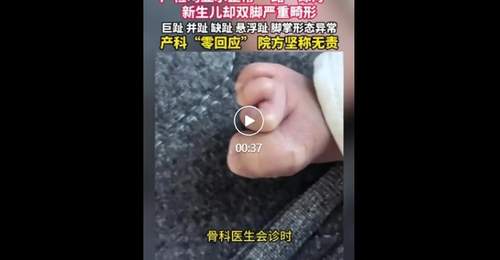 珠海产检一路顺利 新生儿出生后双脚严重畸形 医院称属医学盲区无责任 你遇过这类医学盲区吗？