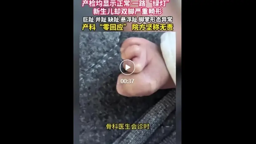 珠海产检一路顺利 新生儿出生后双脚严重畸形 医院称属医学盲区无责任 你遇过这类医学盲区吗？