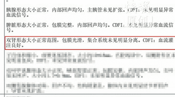 女子三年体检无异常却确诊肾癌，家属质疑漏检，扬州卫健委已介入