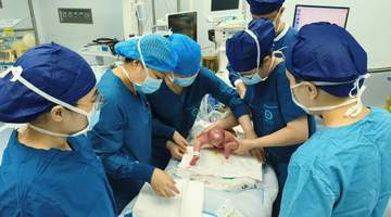 胎儿臀部长出巨型肿瘤,深圳一女婴出生即接受高难度手术